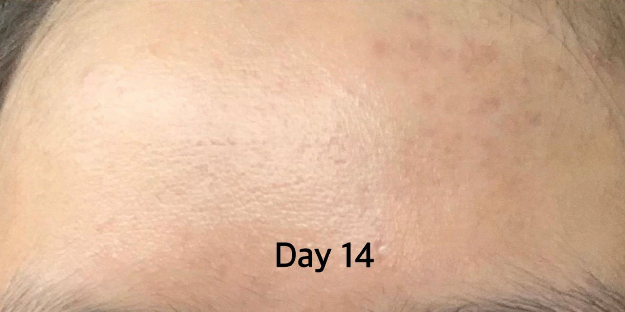 test3-10day